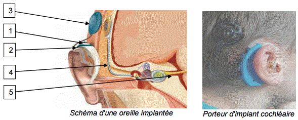 Sujet Physique Chimie Bac 2016 STL Mtropole : image 2