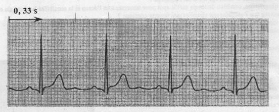 oscilloscope