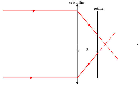 optique