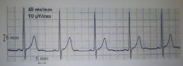 Lecture d\'lectrocardiogrammes