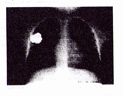 exercice dm physique: etude documentaire sur la radiographie