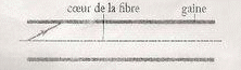 L\'chographie et la fibroscopie