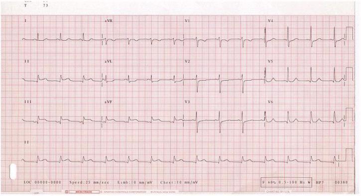 Principes de l\'lectrocardiographie et de l\'lectroencphal