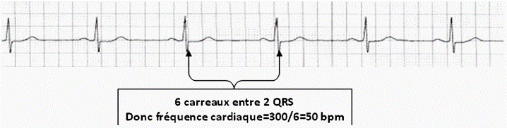 Principes de l\'lectrocardiographie et de l\'lectroencphal