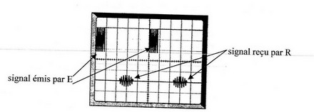 Echographie 2