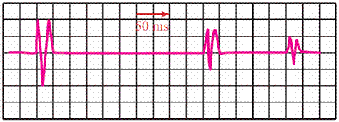 Autre exercice difficile -ondes mcanique-difficile