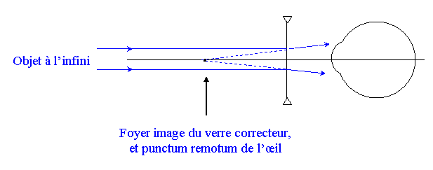 Optique