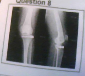 Radiographie
