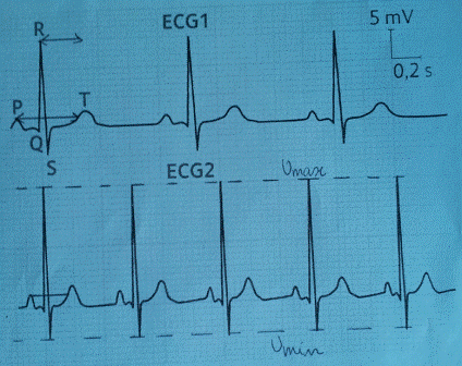 lectrocardiogramme et priodes.