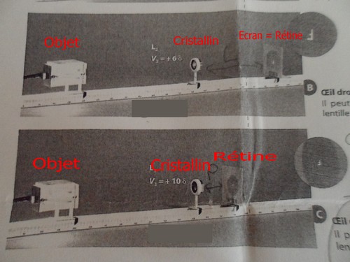 Myope ou hypermtrope ?