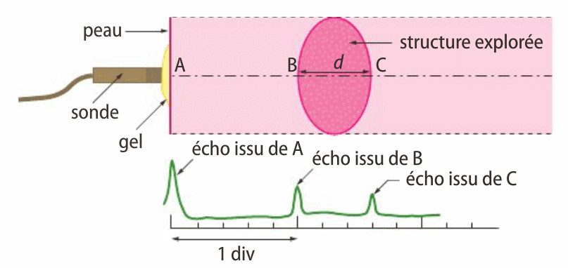 Dm de physique sur les ultrasons