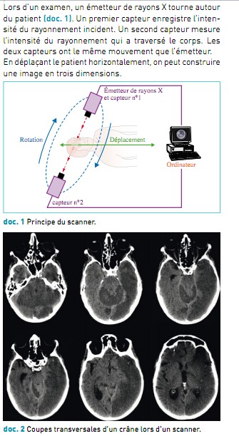 Les ondes au service du diagnostic mdical 