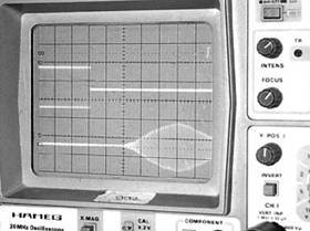 Ondes ultrasonores
