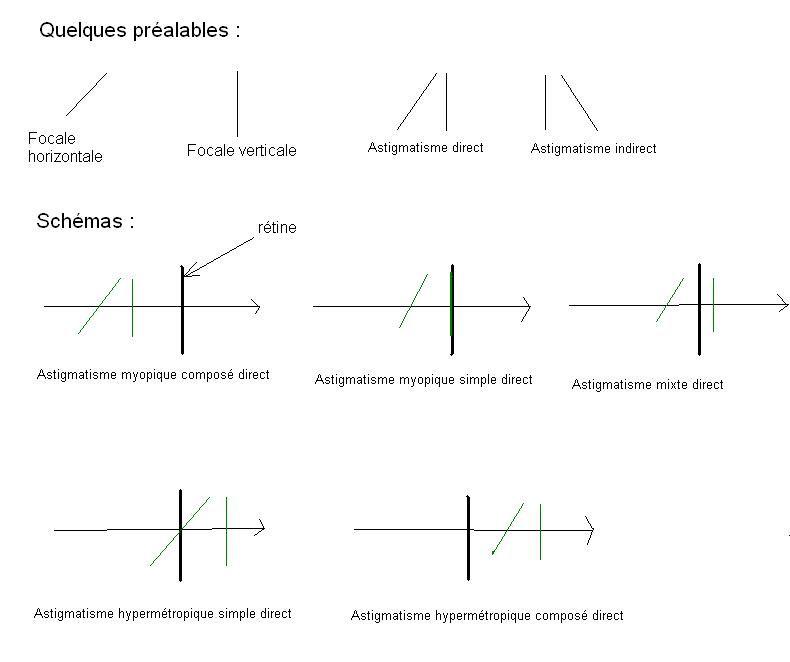 Optique - Cas de l\'astigmatisme