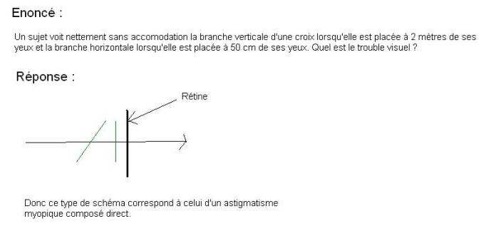 Optique - Cas de l\'astigmatisme