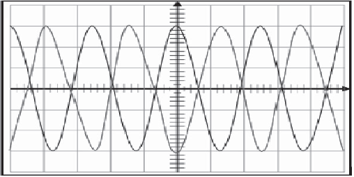 Ondes ultasonores 