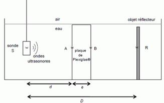 Echographie 