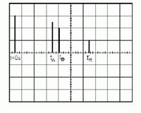 Echographie 
