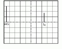Echographie 