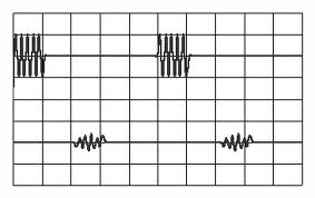 Mesure de la vitesse de propagation des ultrasons
