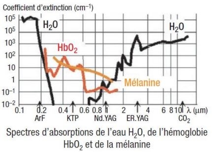 Le detatouage, protection contre le rayonnement laser