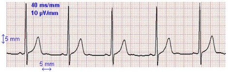 Les phnomnes priodiques : lctrocardiogramme