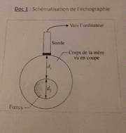 Problme de mesure de distance par chographie