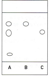 Synthse de l\'acetanilide 