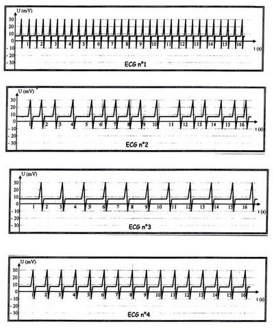 Rythme cardiaque, tension, frquence, valeur max
