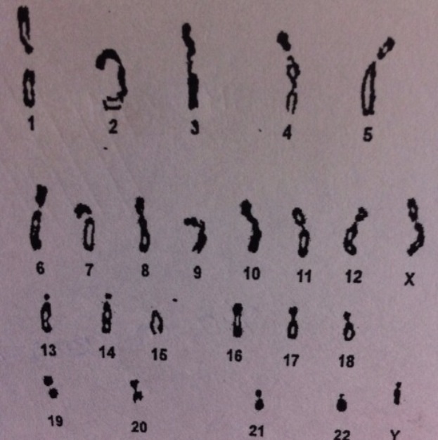 Identifier ce caryotype