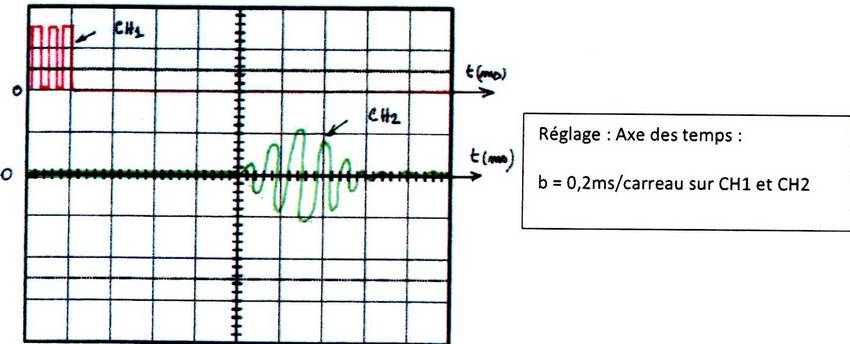 Echographie trouver une distance d 