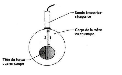 chographie 