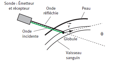Application mdicale de l\'effet Doppler
