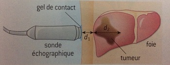Devoir maison sur les ondes de diagnostic