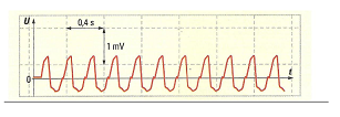 Examen cardiologique