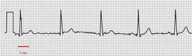 Mthode d\'analyse des signaux avec l\'oscilla