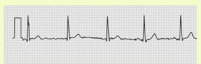 Mthode d\'analyse des signaux avec l\'oscilla