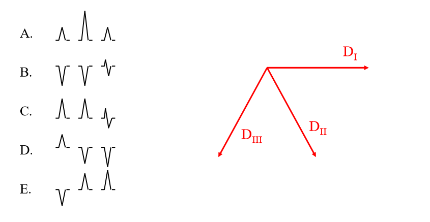 Derivations exercice 