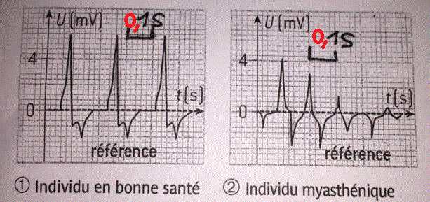 lectromyographie