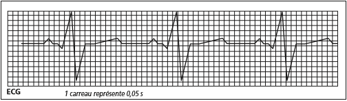 Cycle cardiaque 
