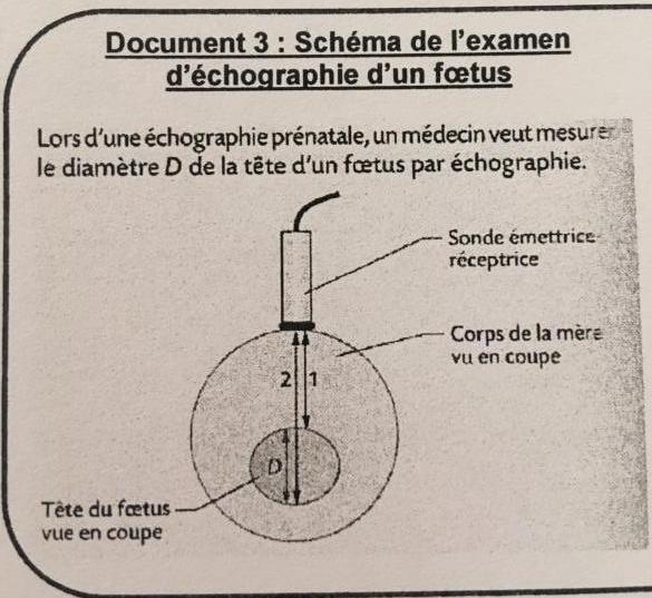 DM de physique chimie 2nde : chographie