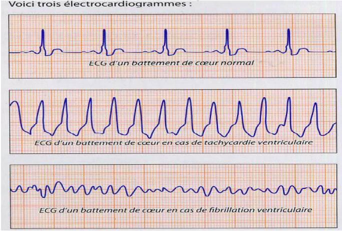 lectrocardiogrammes priodiques ?