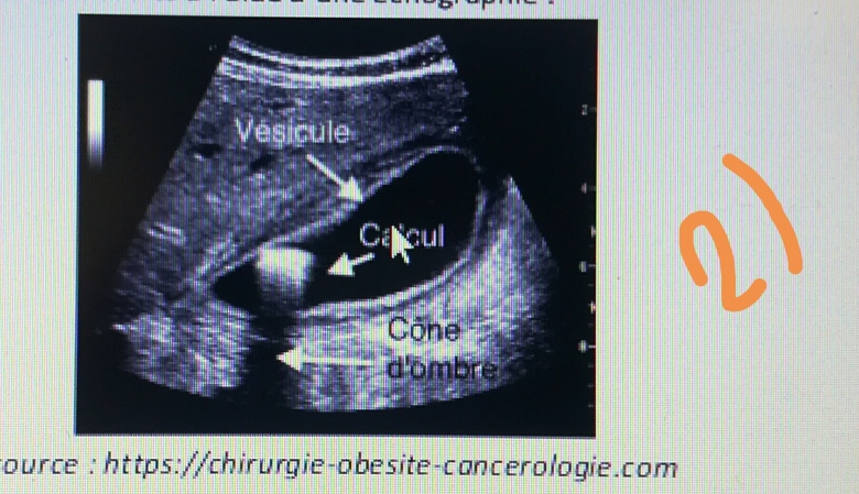 Exercices physique : chographie
